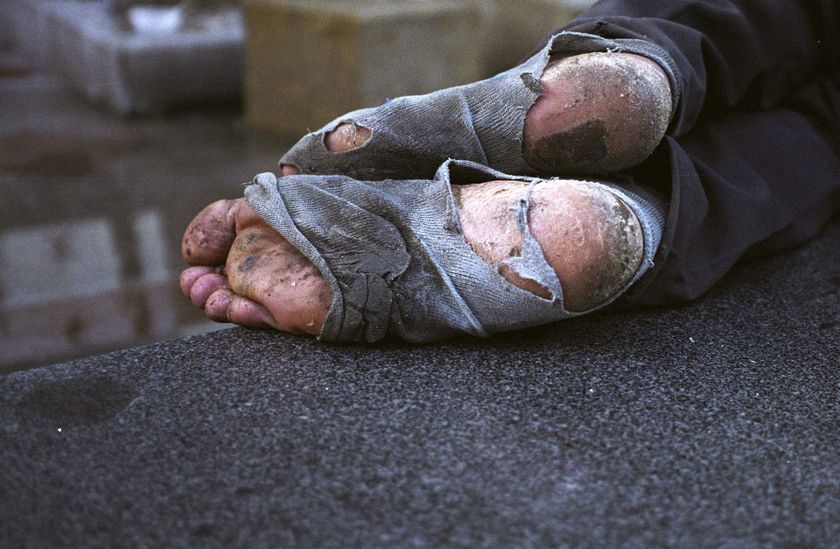 homeless-feet